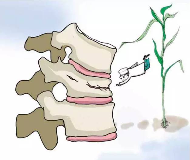 看看脊柱的椎体是否有变形(也叫楔形变或压缩骨折)?