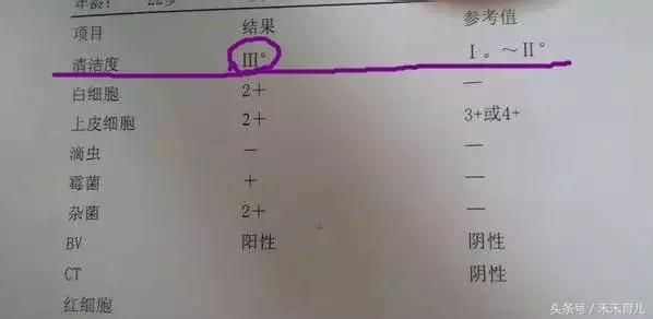 孕期患有霉菌性阴道炎可以顺生吗想顺产需要注意什么