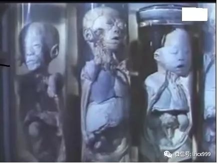 731婴儿实验图片