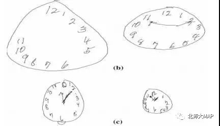画钟表测试老年痴呆症图片