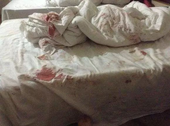 床单上的血落红图片
