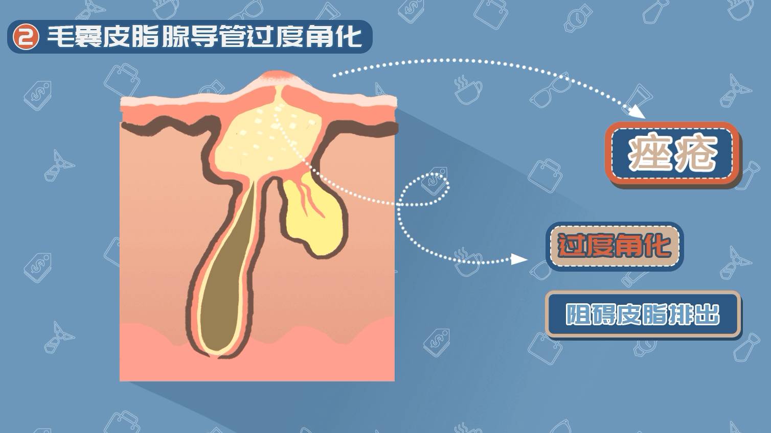 年轻帅气的你却长了一脸痘痘男士长痘痘该怎么护肤祛痘