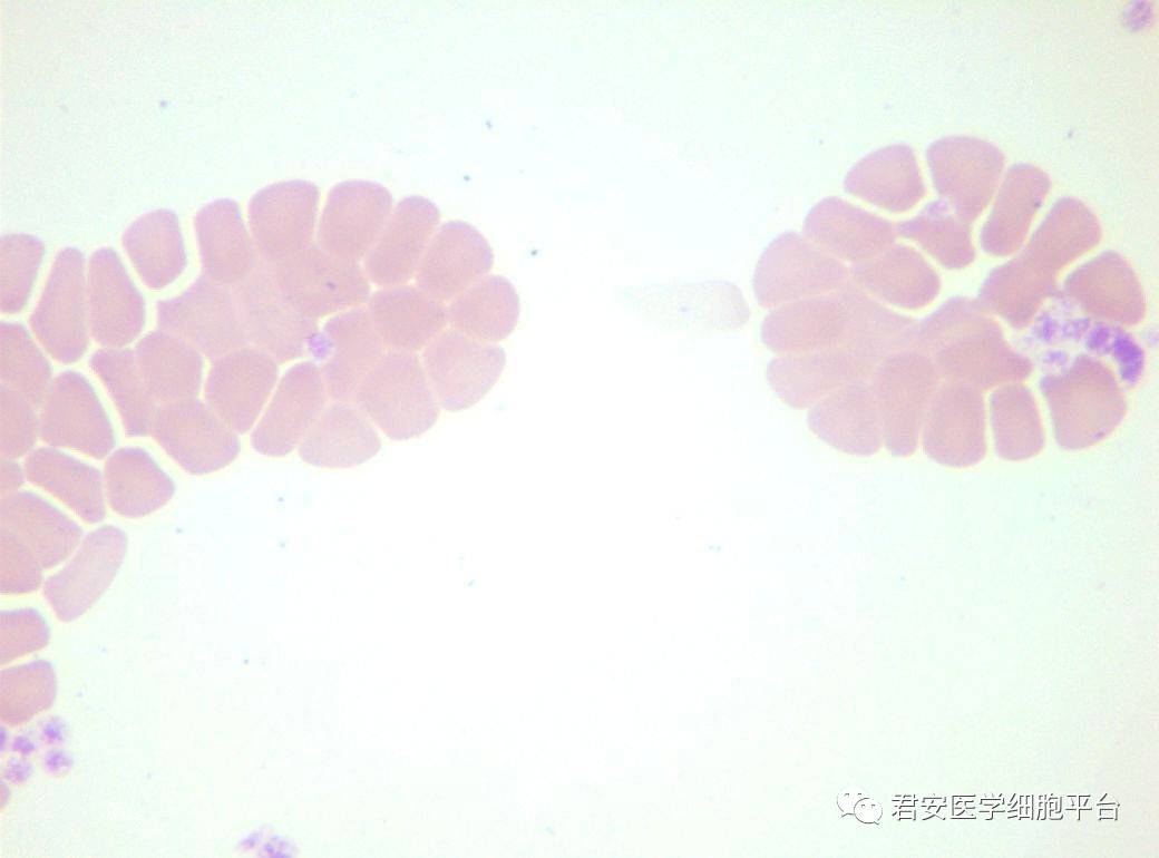 红细胞缗钱状排列居然是因为他