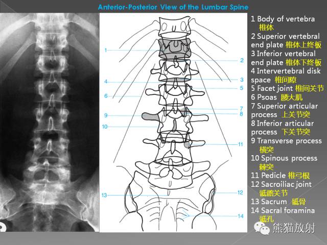 正常腰椎x光片图 图解图片