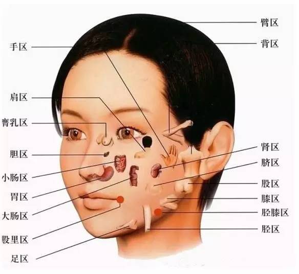 脸上长痘对应的器官图图片