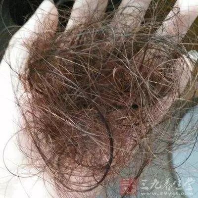 一种多发于特殊生理状态内分泌失调性脱发一种需要来一场精神马杀鸡