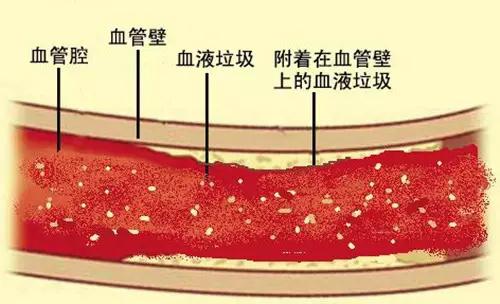 胆固醇引起肥胖心血管疾病怎么办降低胆固醇记住这5招