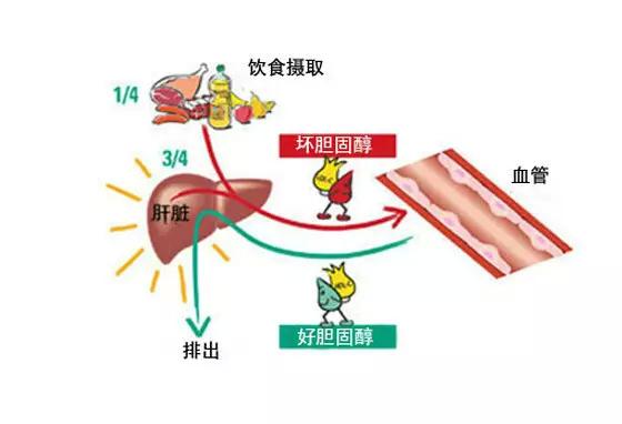 膽固醇引起肥胖心血管疾病怎麼辦降低膽固醇記住這5招