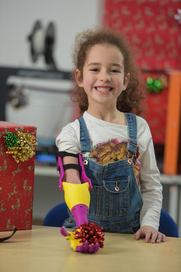 最美的圣诞礼物!6岁残疾女孩收到3d打印义肢,兴奋地尖叫起来