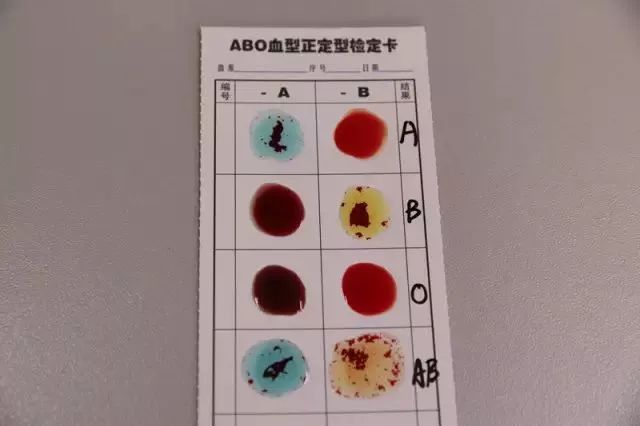 abo血型鉴定结果图图片