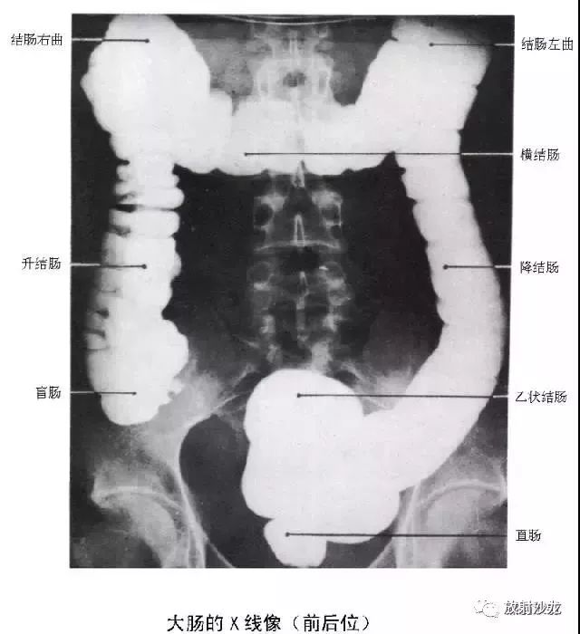 x線解剖消化道造影11組圖咽部至直腸彩色解剖圖