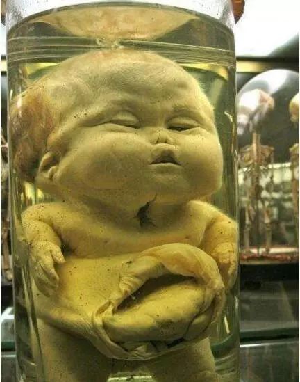 福尔马林泡着的婴儿图片