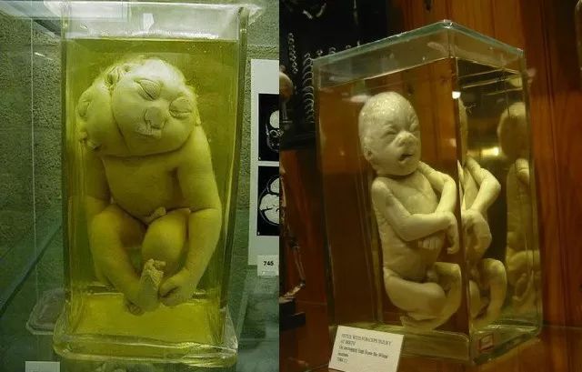 福尔马林泡的婴儿图片图片