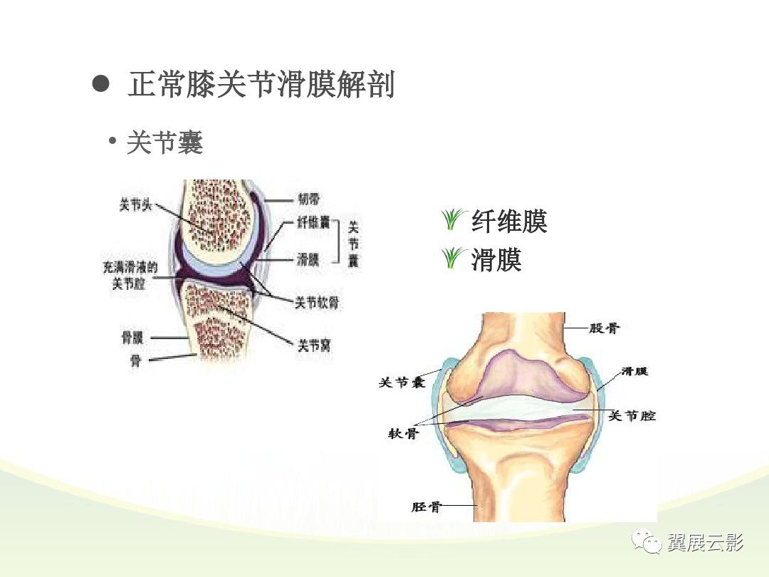 膝关节滑膜病变mri表现