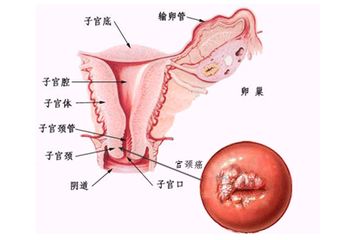宫颈口图片 结构图图片