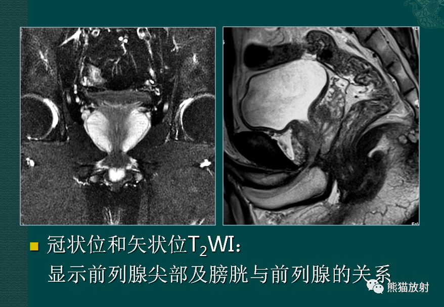 前列腺腎上腺↓ 膀胱壁結構↑ 腹後壁(腎及輸尿管的位置)系統解剖圖