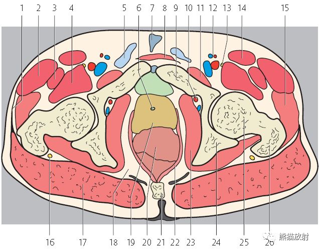 解剖結構:5,精索;6,尿道;7,陰莖懸韌帶;8,腹直肌;9,恥骨;10,閉孔動脈