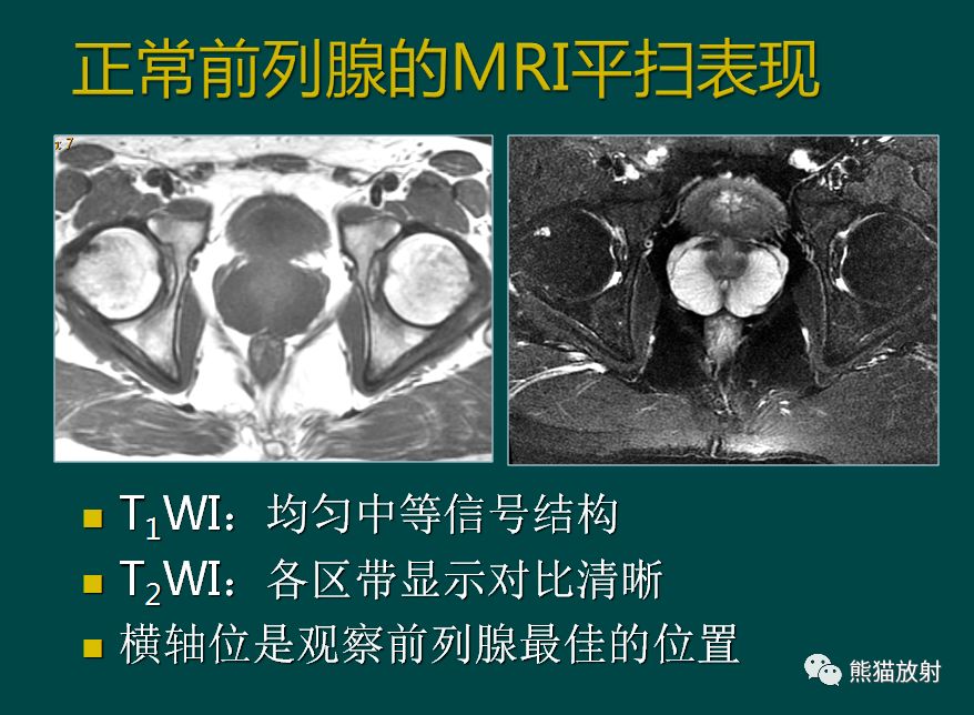 精彩解剖丨腎臟輸尿管膀胱腎上腺前列腺