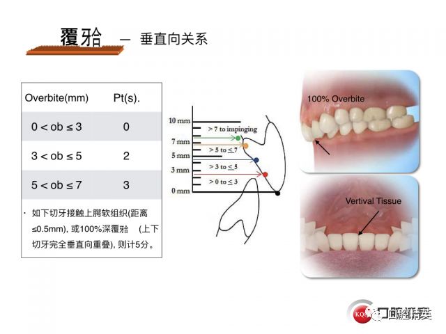 口腔正畸难度评估标准