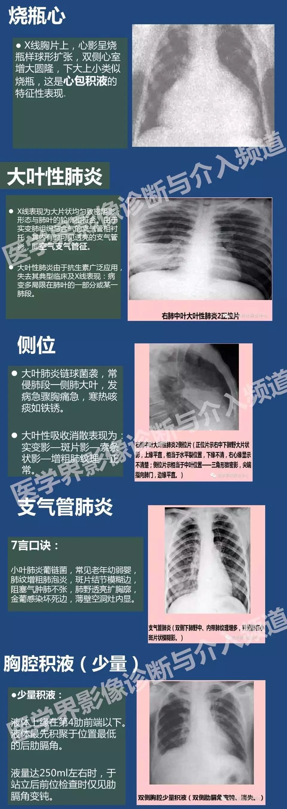 烧瓶心x线图片图片