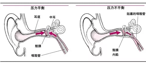 咽鼓管解剖结构图图片