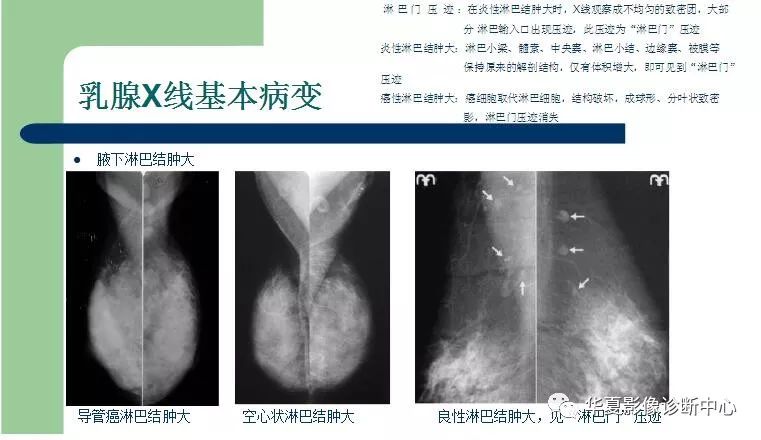 乳腺头尾位图片图片