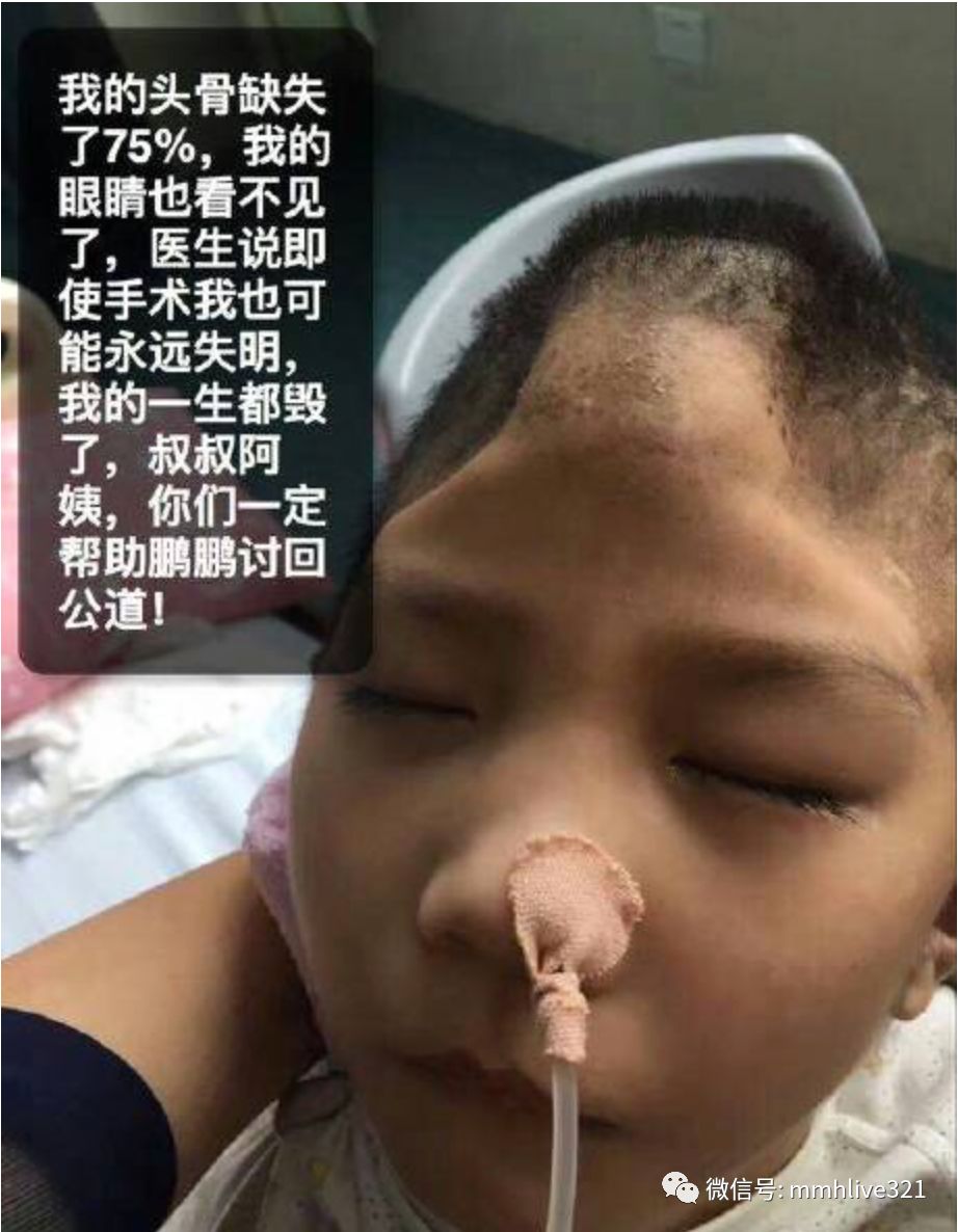 北京红黄蓝幼儿园虐童教师被捕2017欠这些孩子一个公道