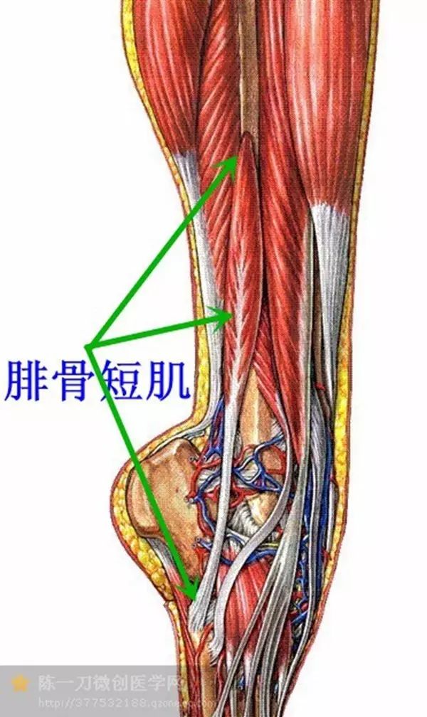 腓骨短肌位置图图片