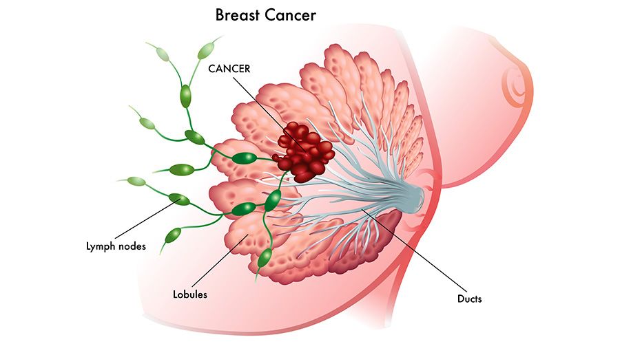 中特別指出:如果發現乳房長