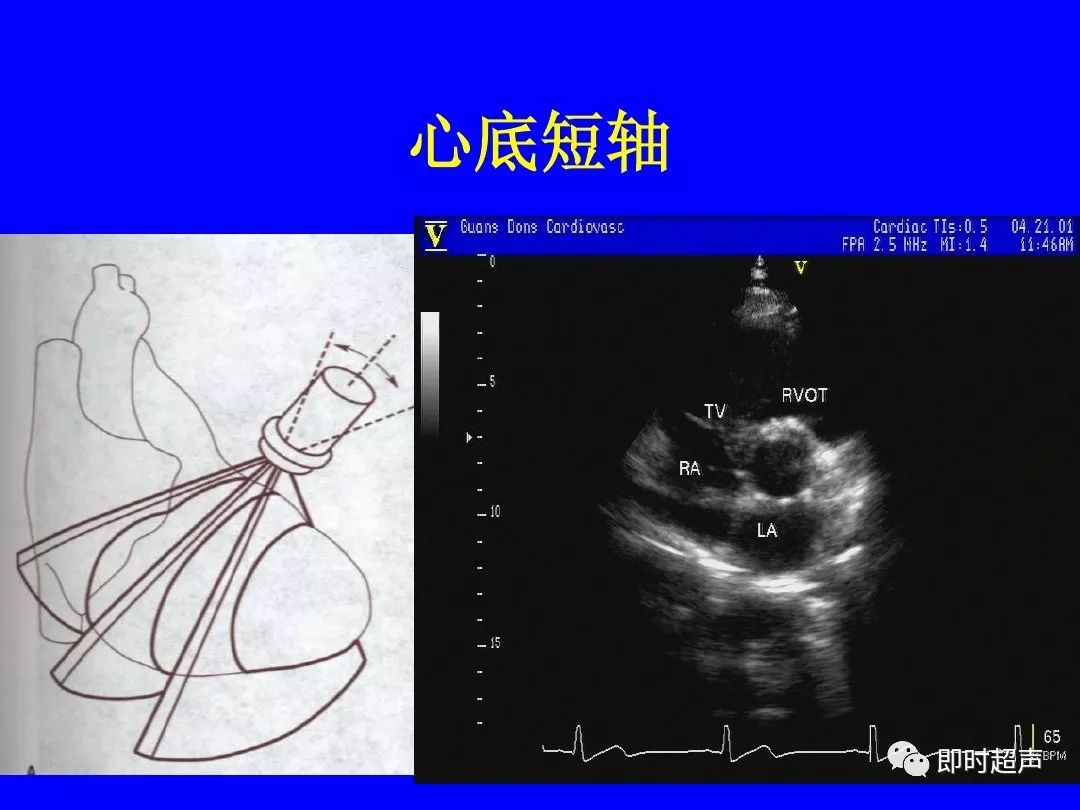 心脏超声标准切面及测量