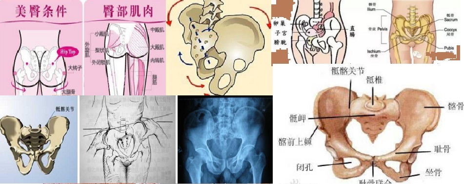 骨盆旋移综合征图片