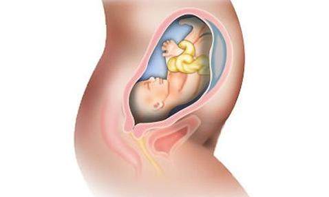 为什么产检时胎儿过小,是孕妈妈吃得不够吗?