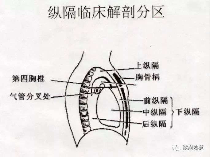 纵膈位置图片