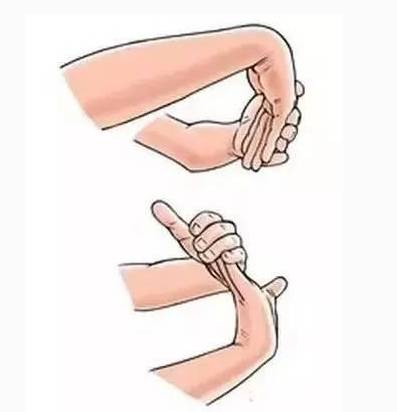3,在搬住患侧手掌或手指使腕关节尽量背伸,维持姿势不动;2,先压住患侧