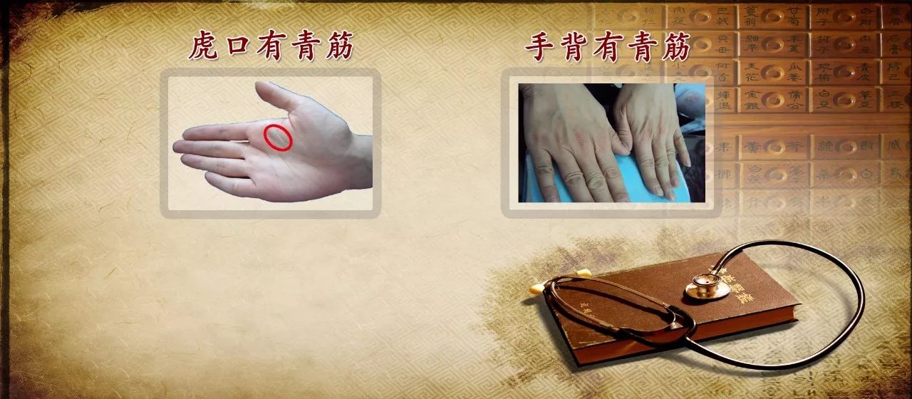 (1)食指和拇指之间有青筋(虎口):可能患有心脑血管疾病(2)手背部青筋