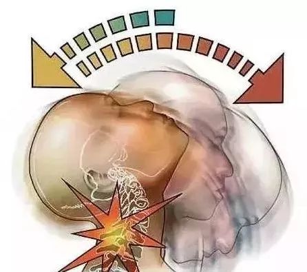 多数头痛缘于颈椎