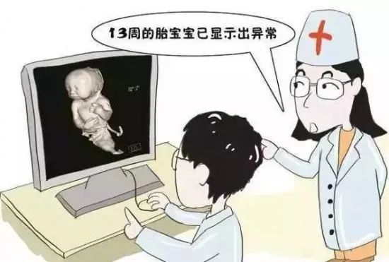 23染色体异常婴儿照片图片