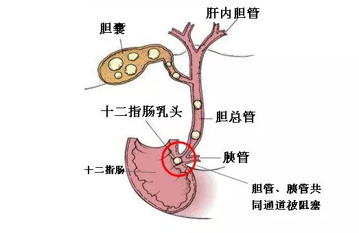 胆管和胰腺连接图片图片
