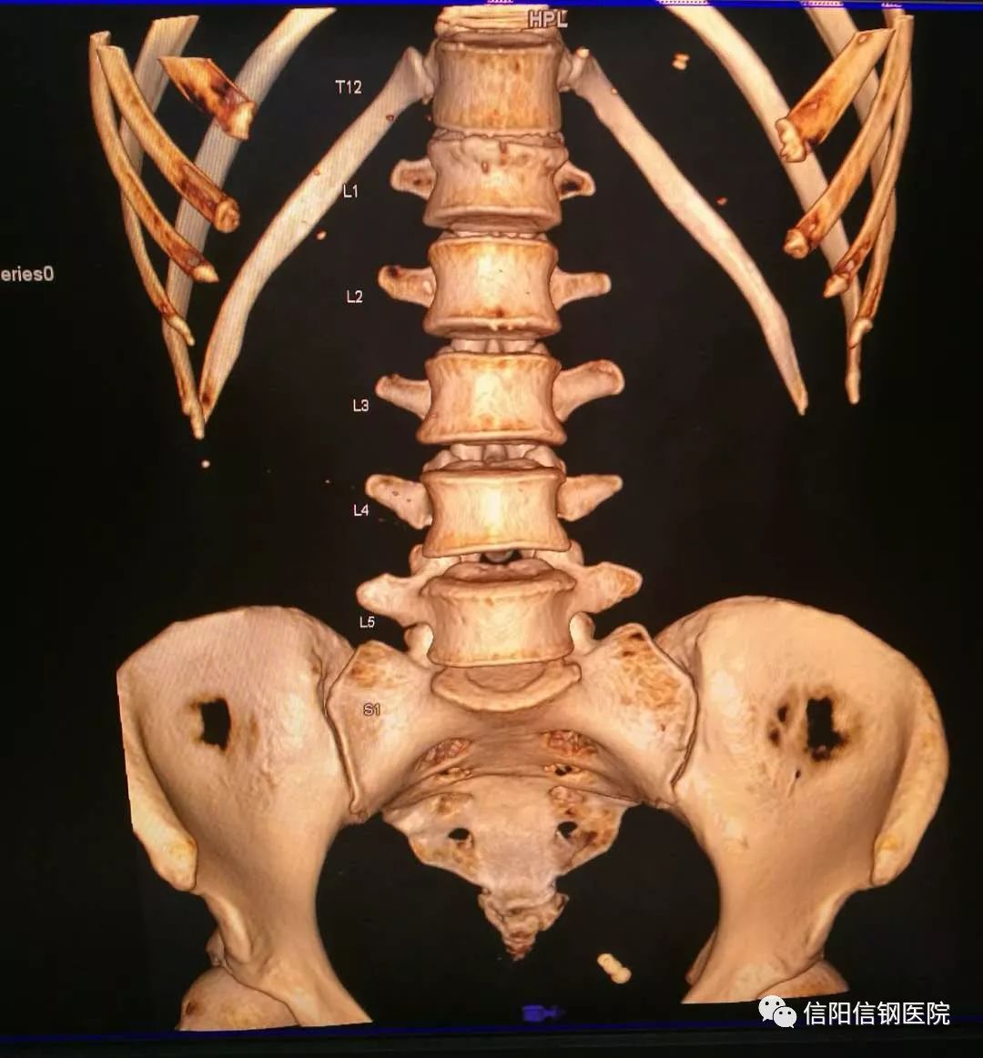 螺旋ct片子图片