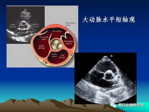 超声心动图是利用超声的特殊物理学特性检查心脏和大血管的解剖结构及