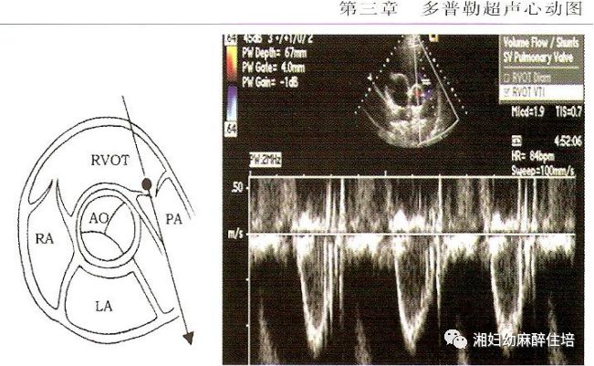 超声心动图是利用超声的特殊物理学特性检查心脏和大血管的解剖结构及