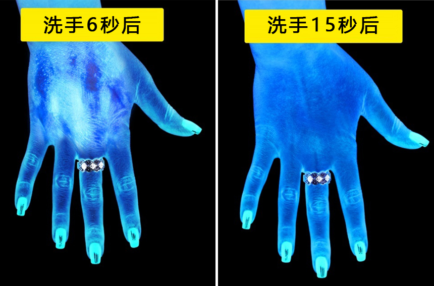 洗手前后细菌对比图片