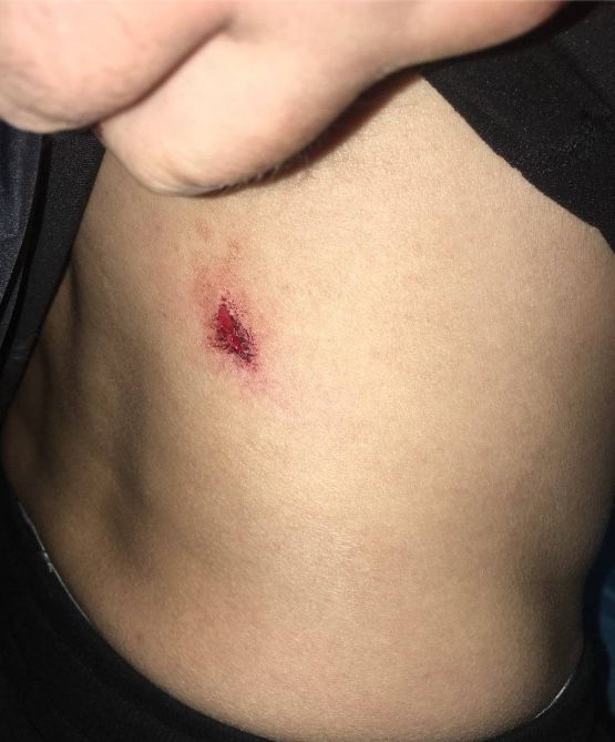 今日凌晨2点,宜宾一男子在金沙广场被4人提刀追砍,吓人!