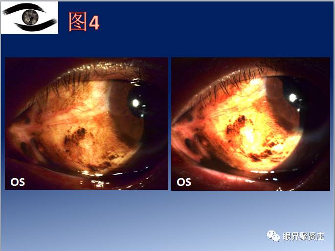 看图识病九宫格系列丨角结膜疾病篇