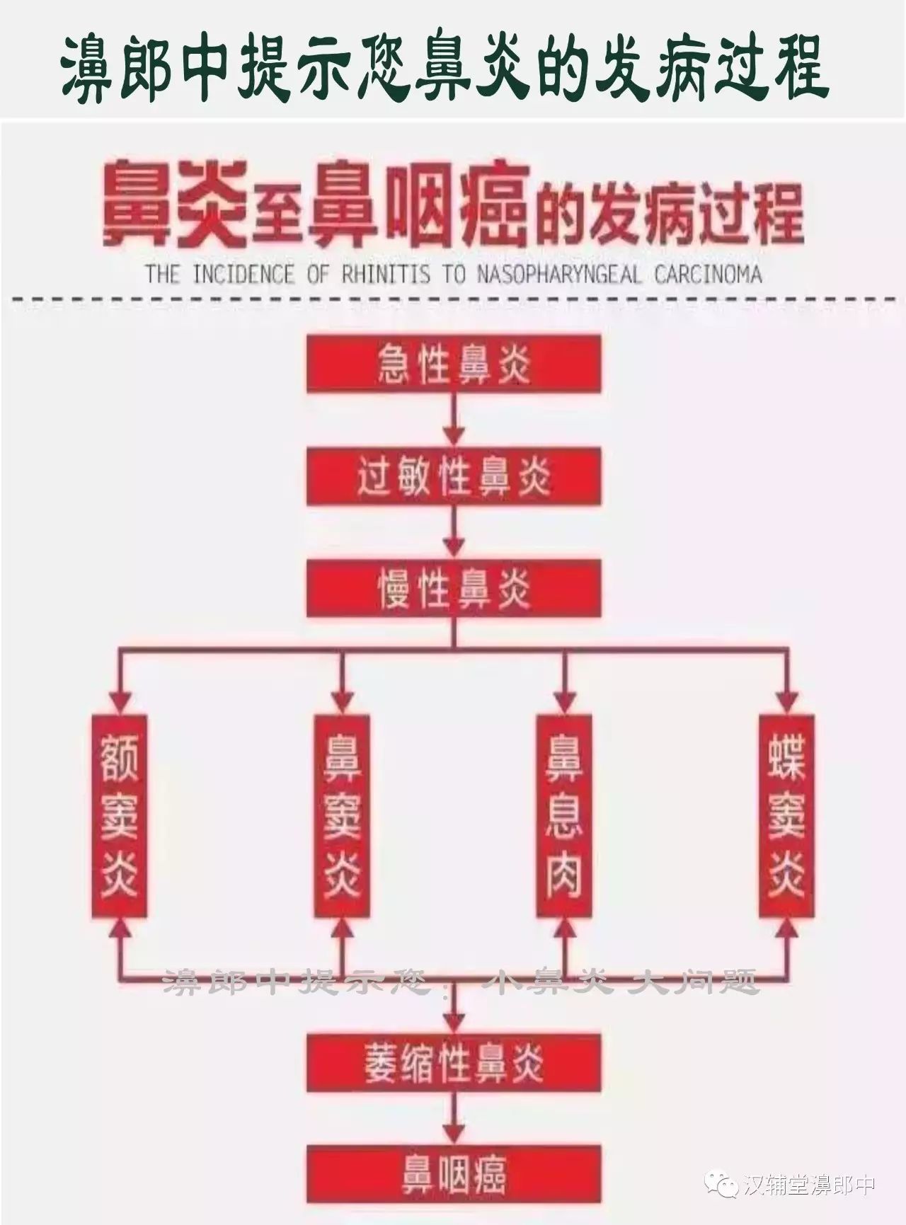 濞郎中讲堂:早期鼻咽癌别当成鼻炎,鼻咽癌早期5大早期信号需警惕