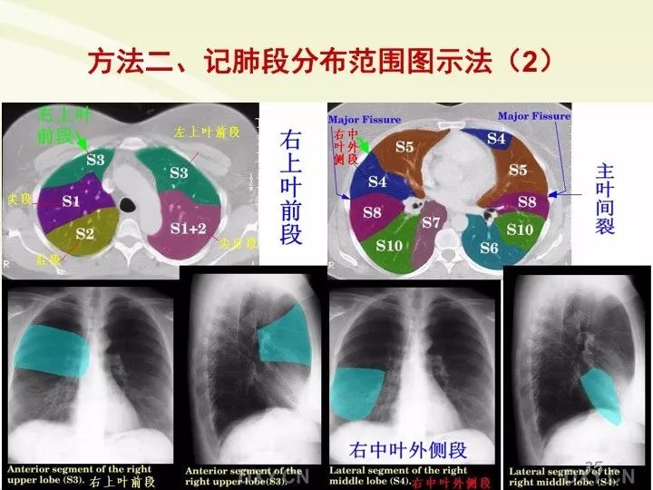 肺部ct分段解剖图图片