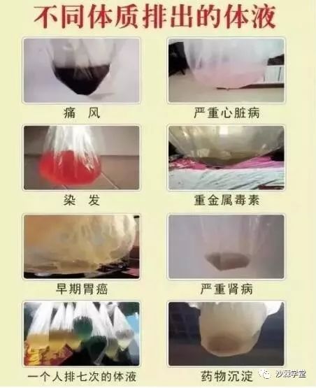 沙棘排湿排寒排酸排毒排去体内所有负能量