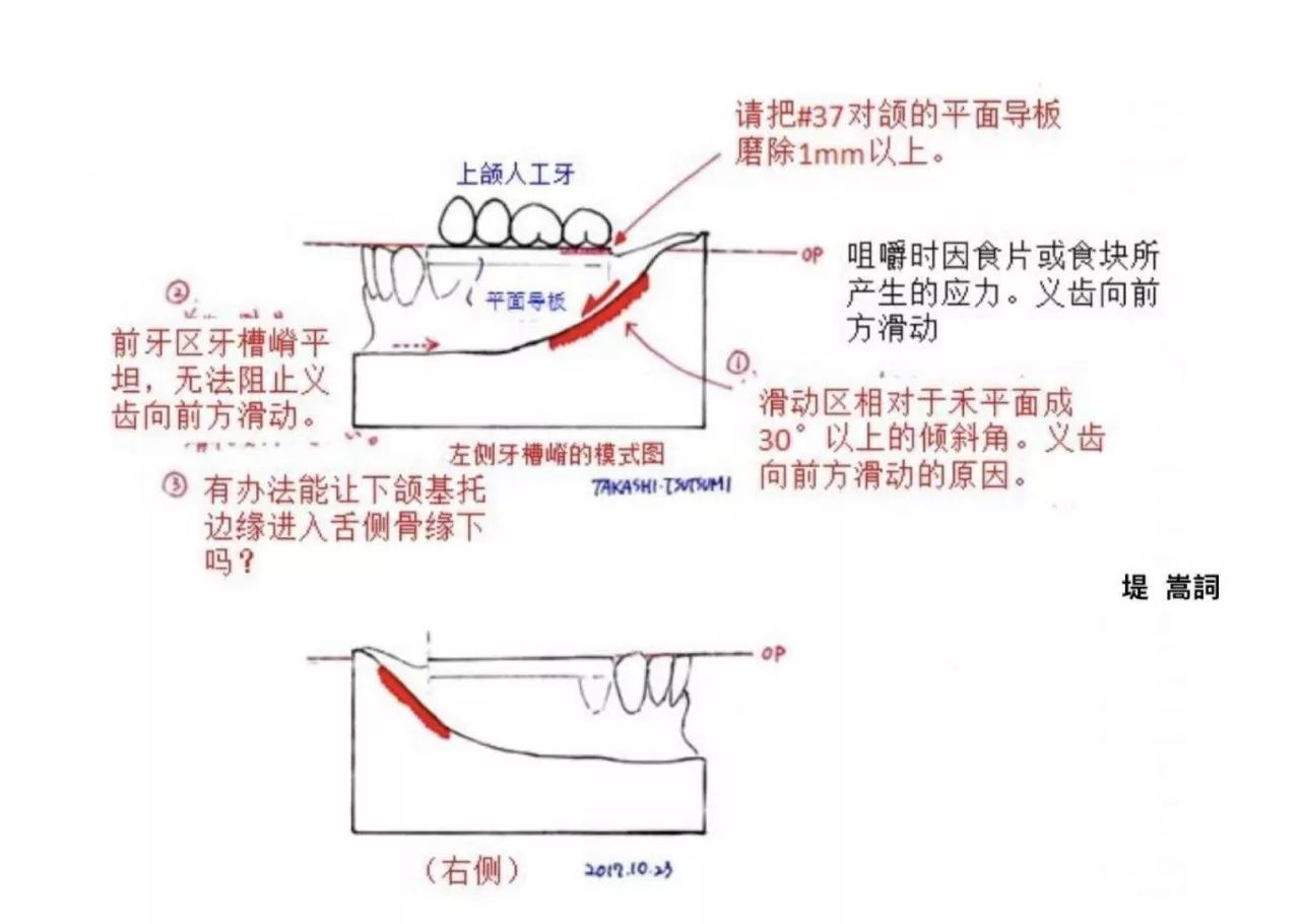 2018齿道微信分享课胡常红全口义齿概论下图文版