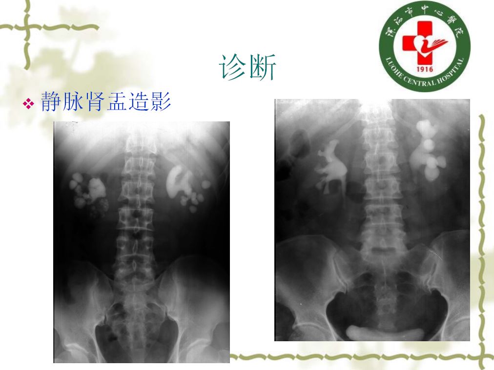 女性B型大全盆腔图片