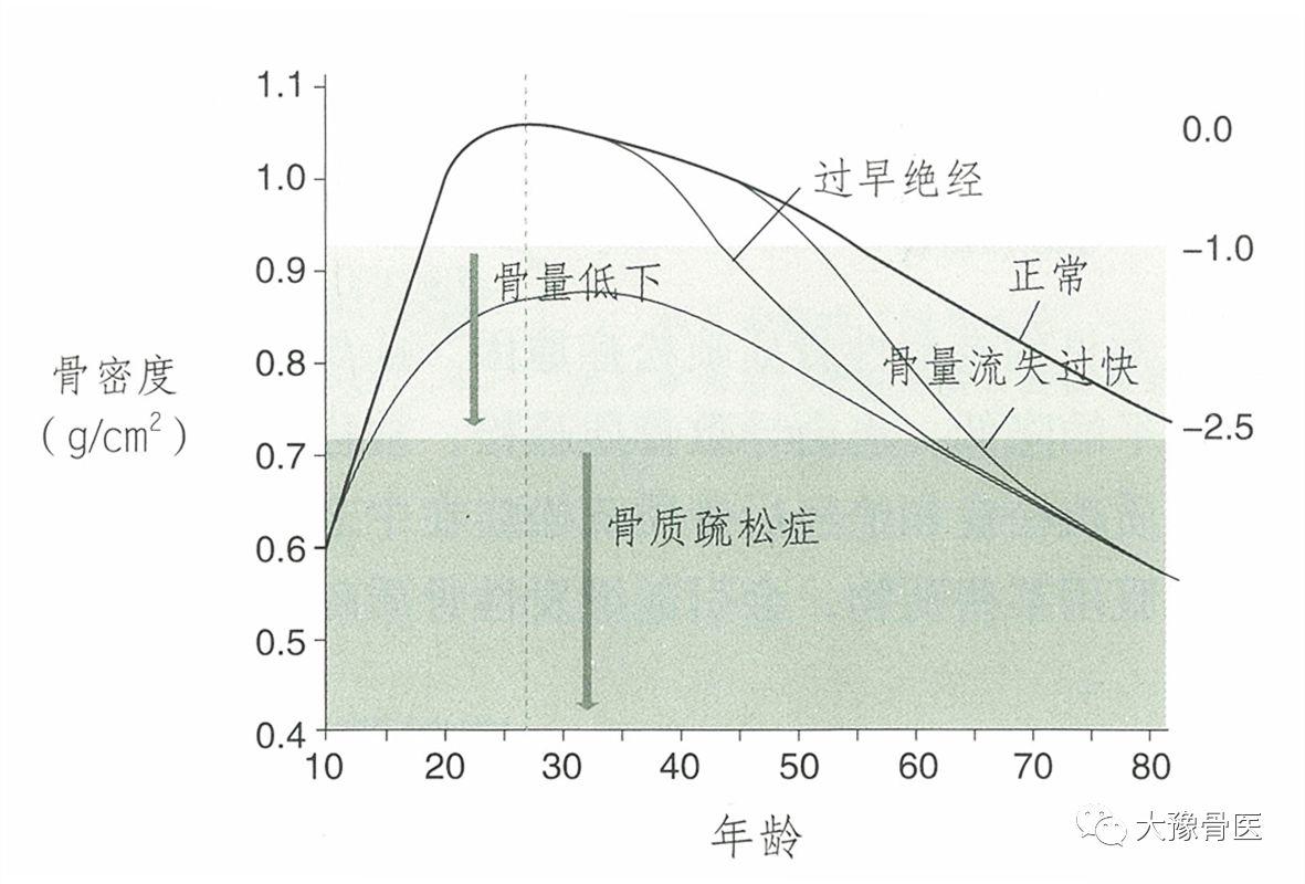 明显下降,所以绝经后女性的骨量流失明显快于老年男性.